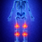 Ζ ΕΠΙΜΗΚΥΝΣΕΙΣ (1)